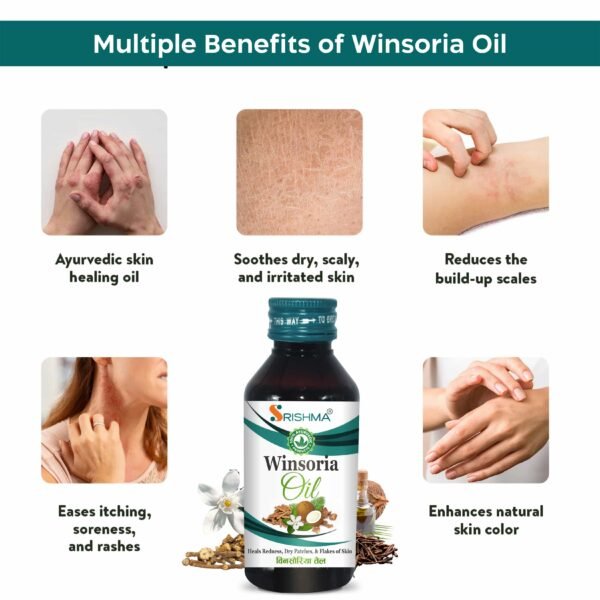 Srishma Winsoria Oils | minimizes itching, discoloration of skin |2×100 ml | - Image 2