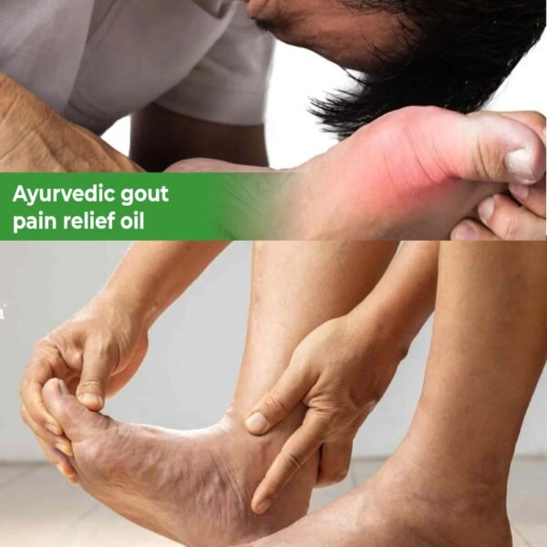 Srishma Ayurvedic Pinda Thailam | Gout Joint Pain Relief Oil | 2×100 ml | - Image 3